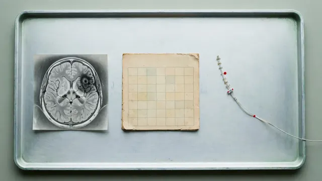 Illustrasjon: Tre medisinske gjenstander — en hjerneskanning, en gulnet kalenderside og en tynn hjerneimplantat-elektrode — ligger atskilt på et blekt sykehusbrett, sett ovenfra.